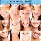 Snap-On Veneers Teeth – Instant Whitening Smile for Men & Women