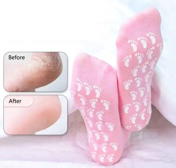 Moisturizing Spa Gel Socks