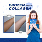 Frozen Collagen 2 in 1 Whitening X10 by Gluta Frozen – Made in Thailand – 60 Capsules